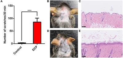 The Role of Gut Microbiota in Chronic Itch-Evoked Novel Object Recognition-Related Cognitive Dysfunction in Mice